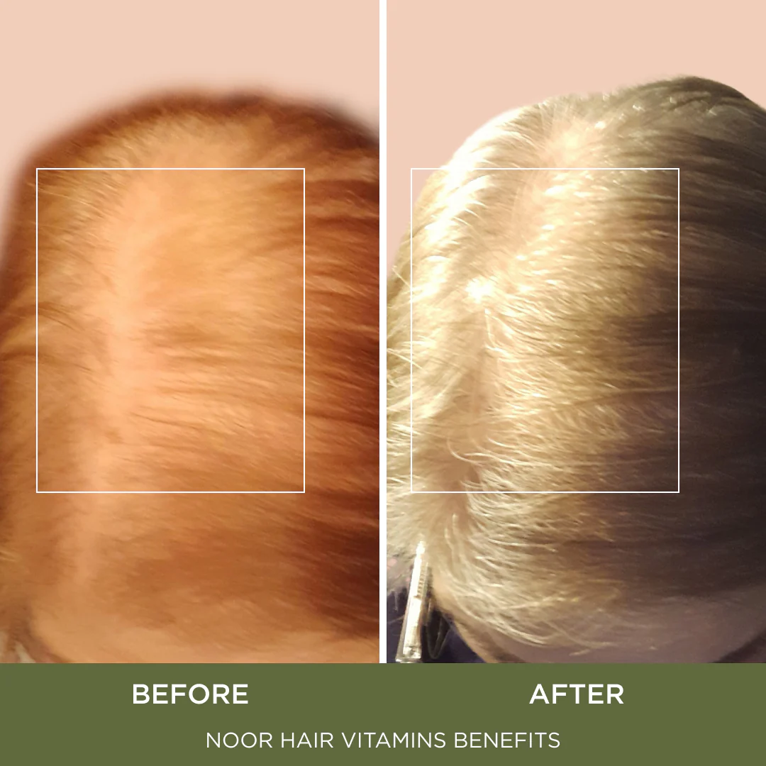 Healthy Hair Formula - Image 3