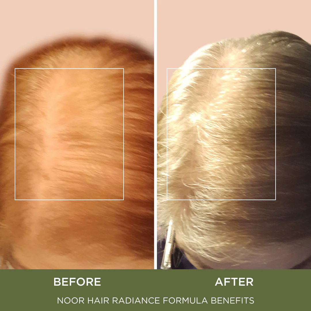 Radiance Formula - Image 4