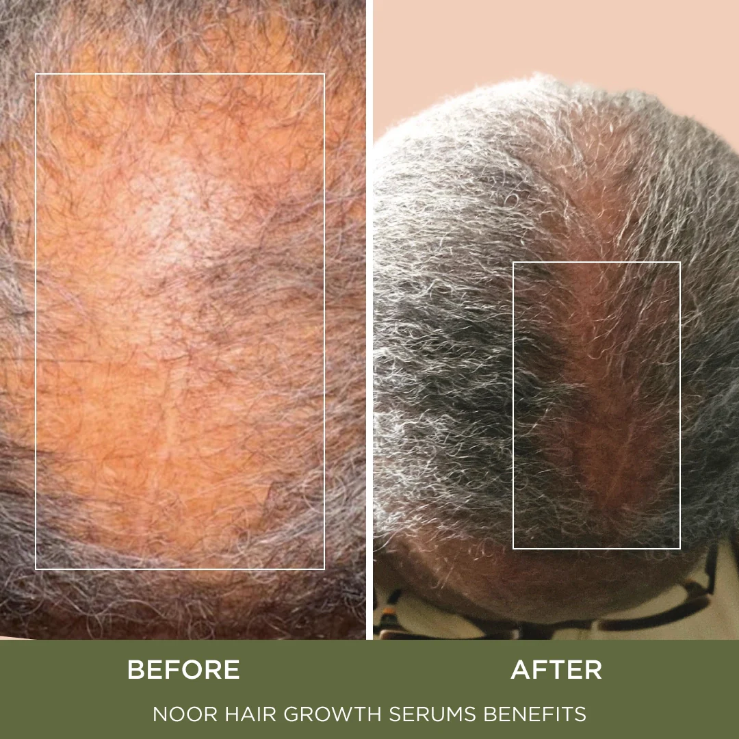 Super Hair Serum - Image 5